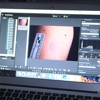 bruising research